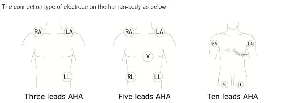 5-zvodové EKG zvodové vodiče pre philips digitrak plus 24-hodinový holter 3100A, 5-zvod, Snap