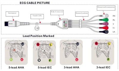 Ako správne pripojiť kábel EKG so zvodovými vodičmi k monitoru pacienta?
